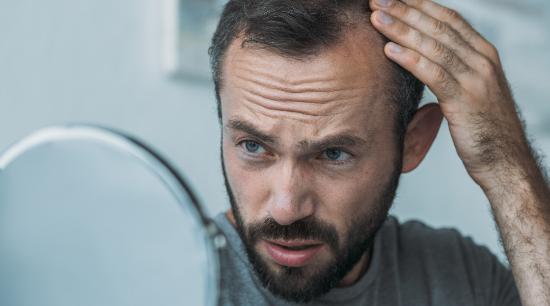 Splitting Hairs: Can CBD Help Reduce Hair Loss?